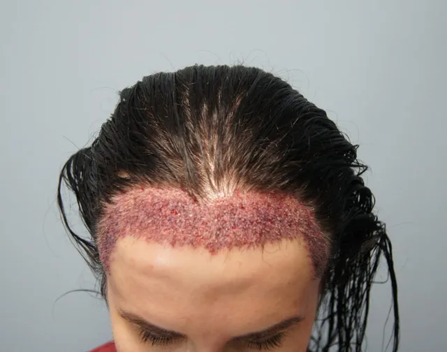 Unshaven female technique