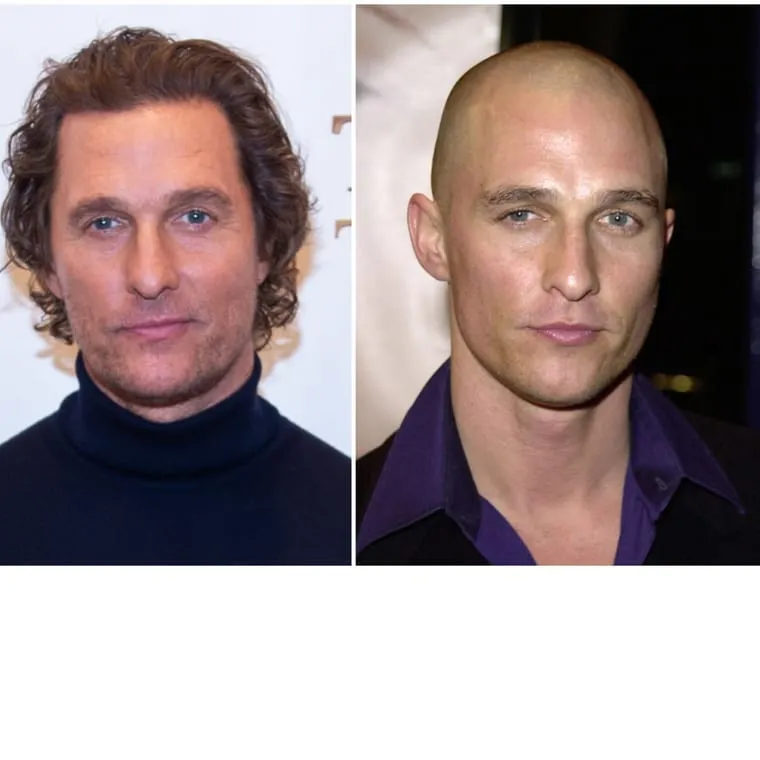 Matthew McConaughey before and after