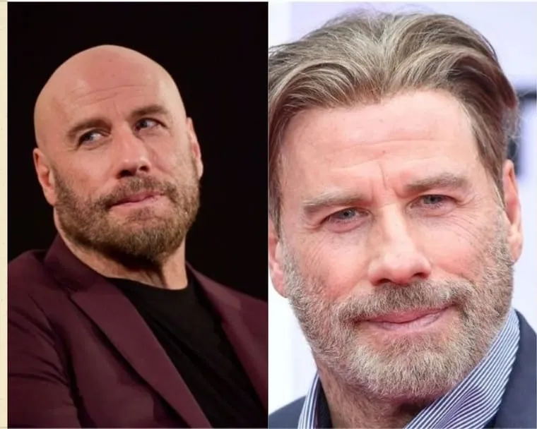John Travolta before and after