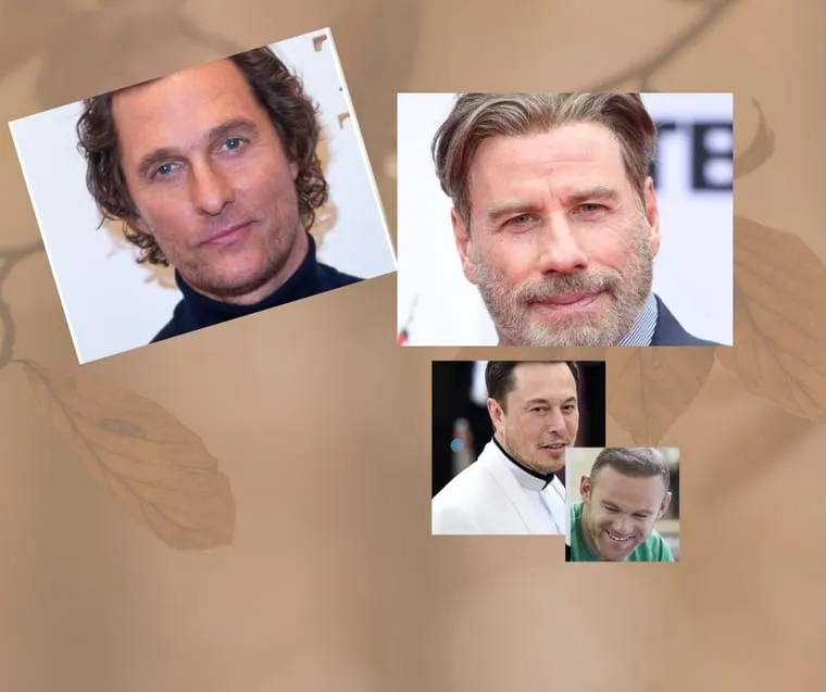 A selection of male celebrities before and after hair transplants