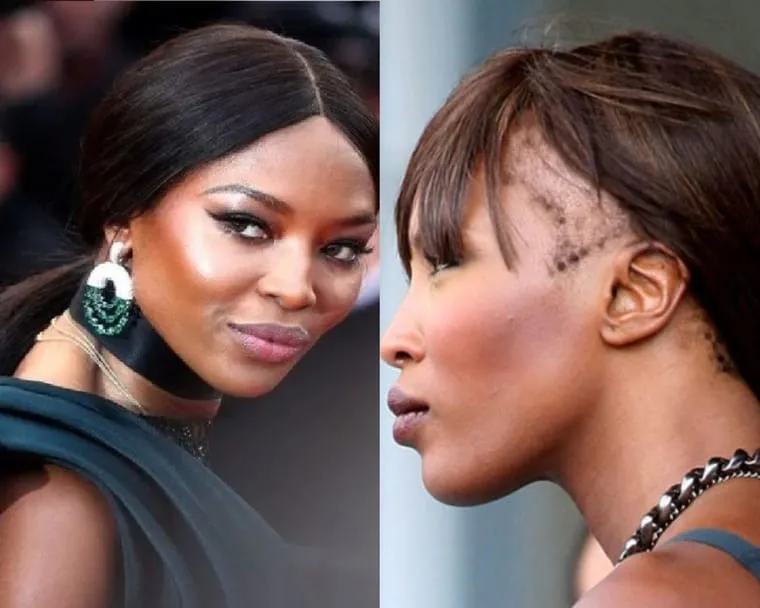 Naomi Campbell before and after
