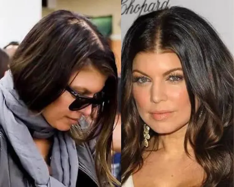 Fergie before and after