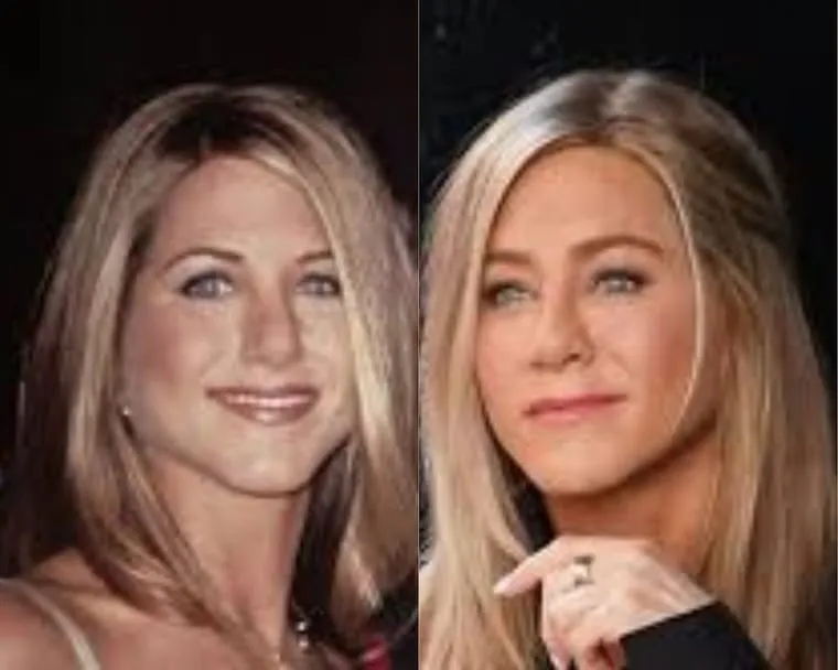 Jennifer Aniston before and after