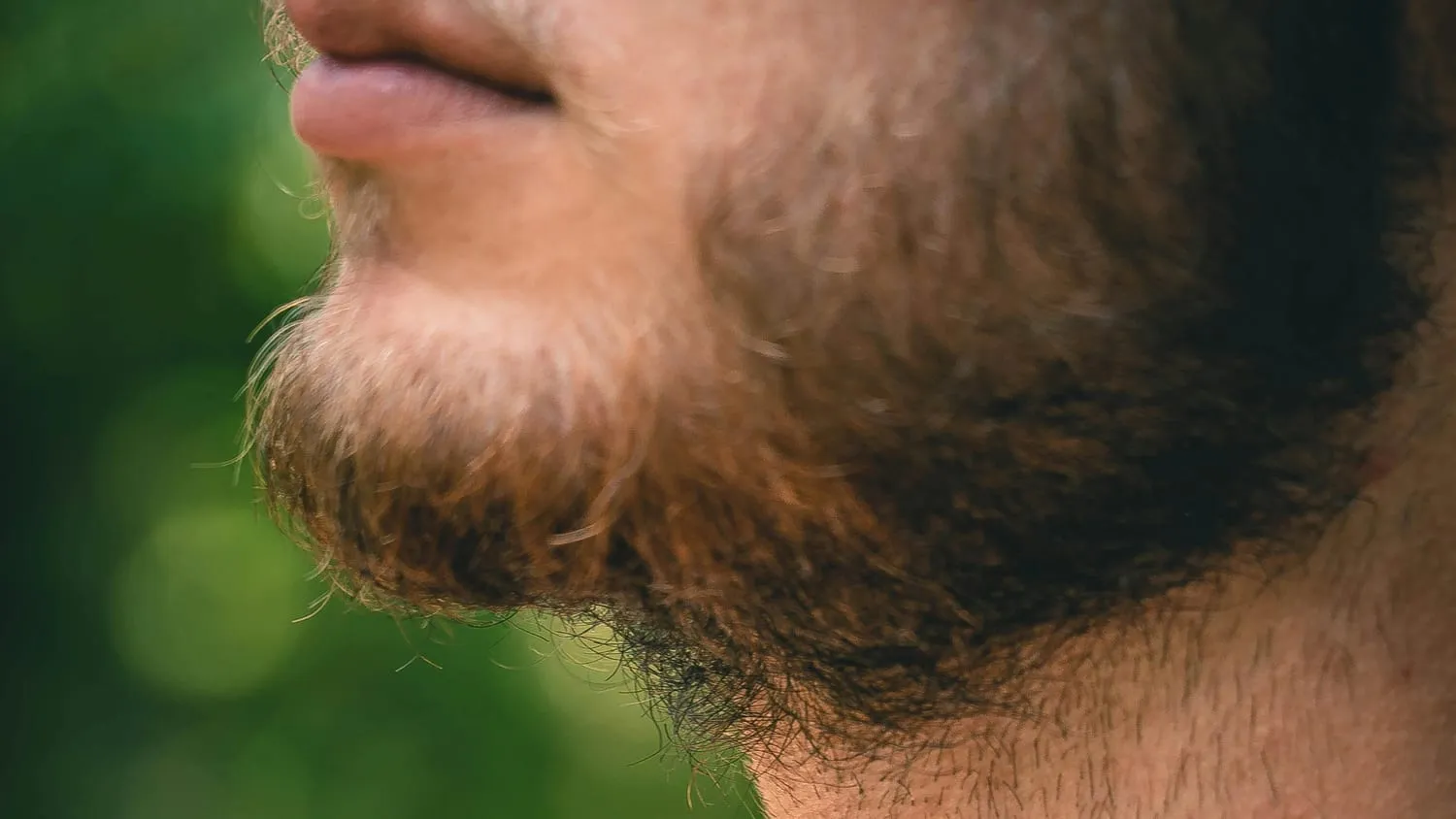 Close-up of a full, healthy beard after a beard transplant