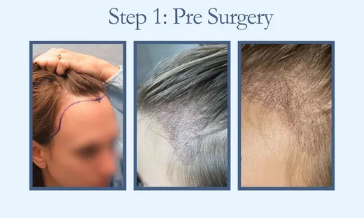 Before surgery